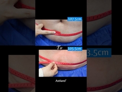 หยุดไขมัน ลด 4 ซม.ใน 1 ชั่วโมง