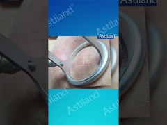 HIFU VS CO2 Laser คุณชอบการรักษาแบบไหน