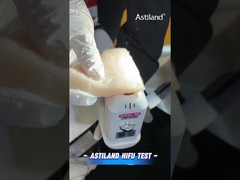 การทดสอบพลังงาน HIFU