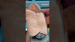 HIFU โดม่าลิสติ้งหน้า #เครื่องสวย #hifu #ผิวขาว #คลินิกความงาม #ผิวสว่าง #อัลตรัสโว