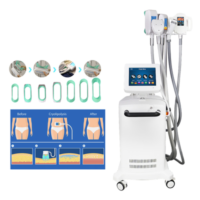 คูลลิ่งประติมากรรม Cryolipolysis Slimming Machine สำหรับการลดไขมัน